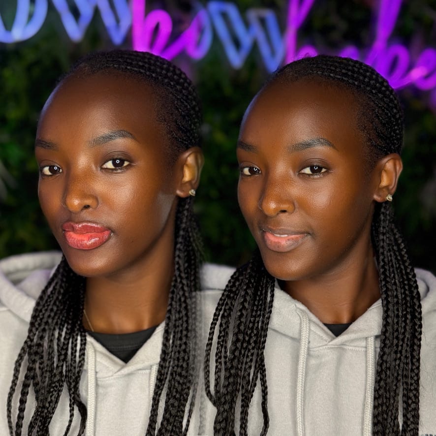 Dark lip neutralization Louisville — melanin-rich lips